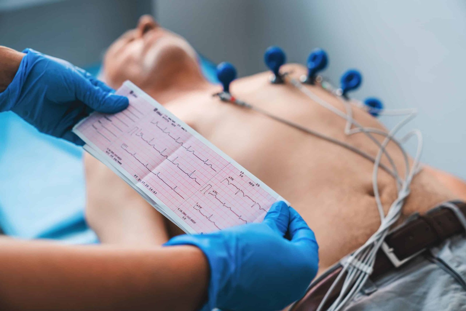Eletrocardiograma