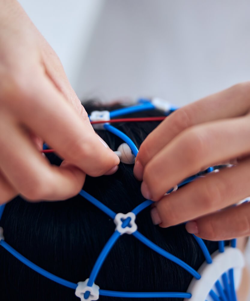 Eletroencefalograma na Prezecor