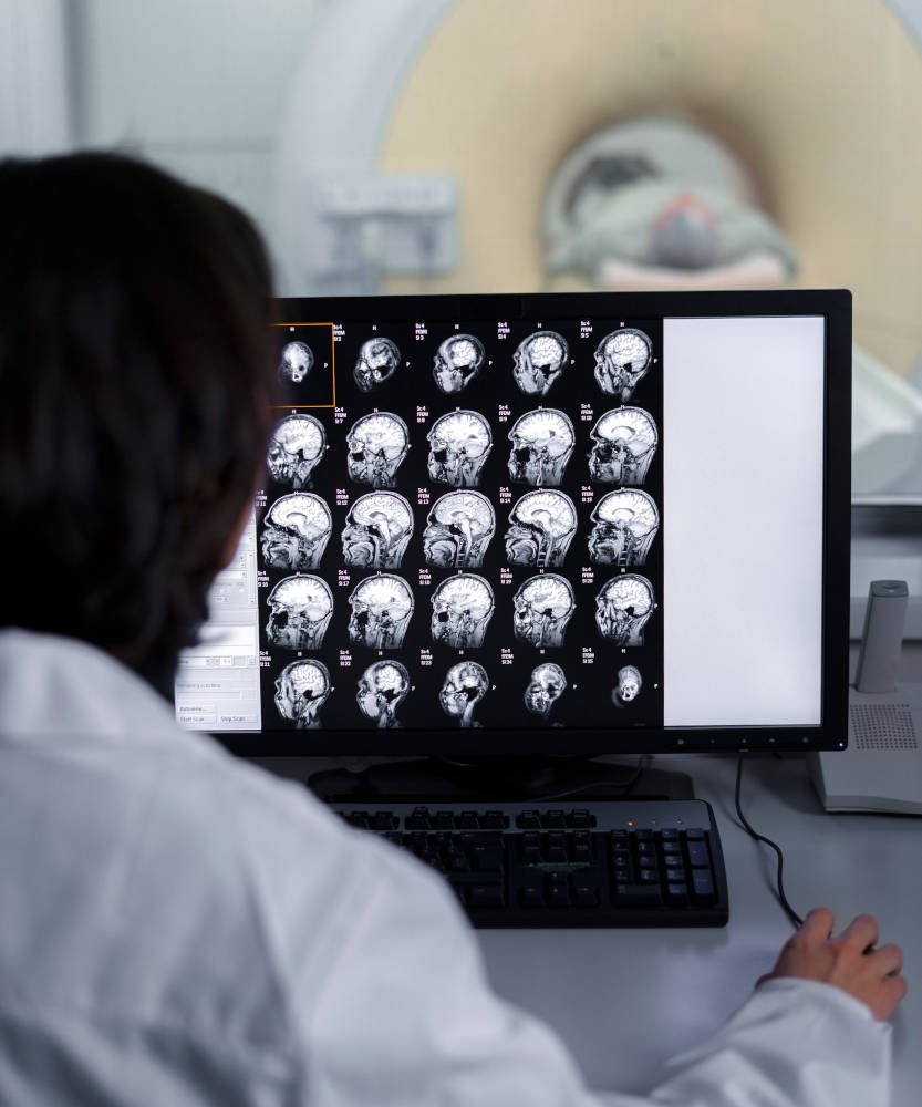 Tomografia do Crânio na Prezecor