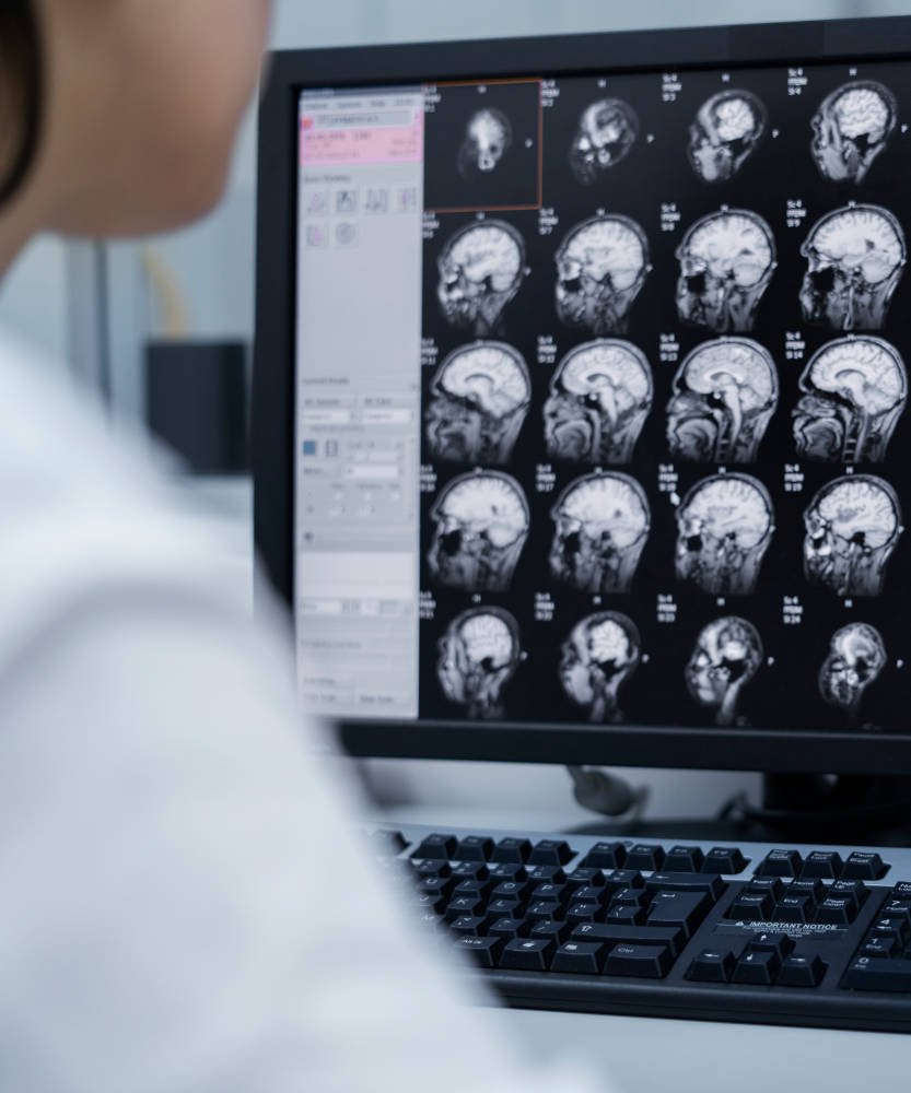 Tomografia do Crânio na Prezecor